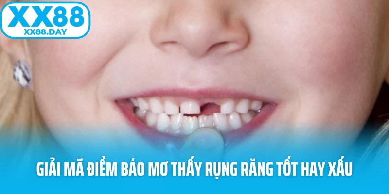 Hé Lộ Bí Ẩn Sau Giấc Mơ Thấy Rụng Răng Khiến Ai Cũng Lo - Slotmira