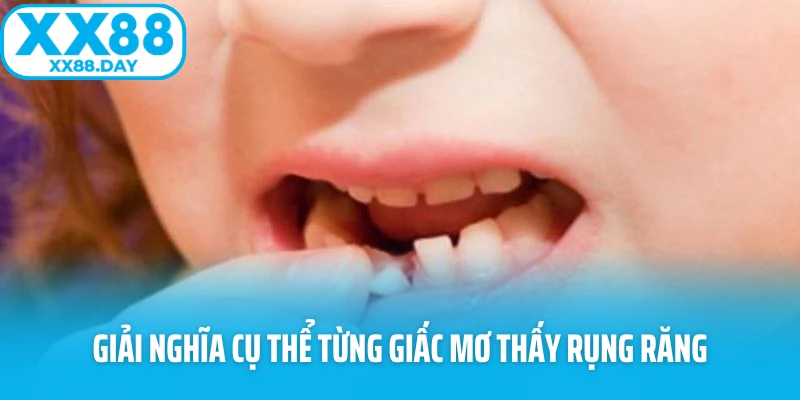 Hé Lộ Bí Ẩn Sau Giấc Mơ Thấy Rụng Răng Khiến Ai Cũng Lo - Slotmira